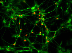 ALS research