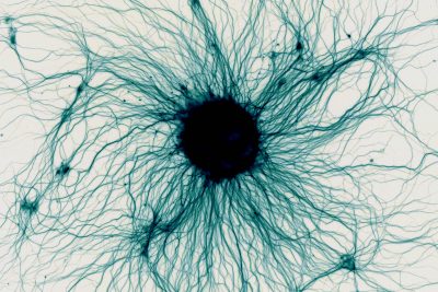 ALS Research