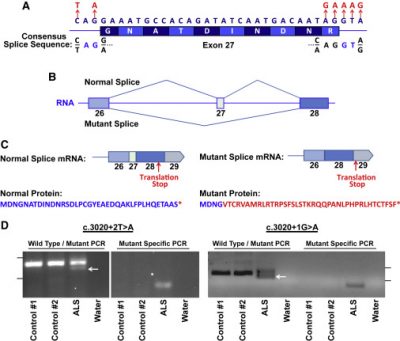 ALS research